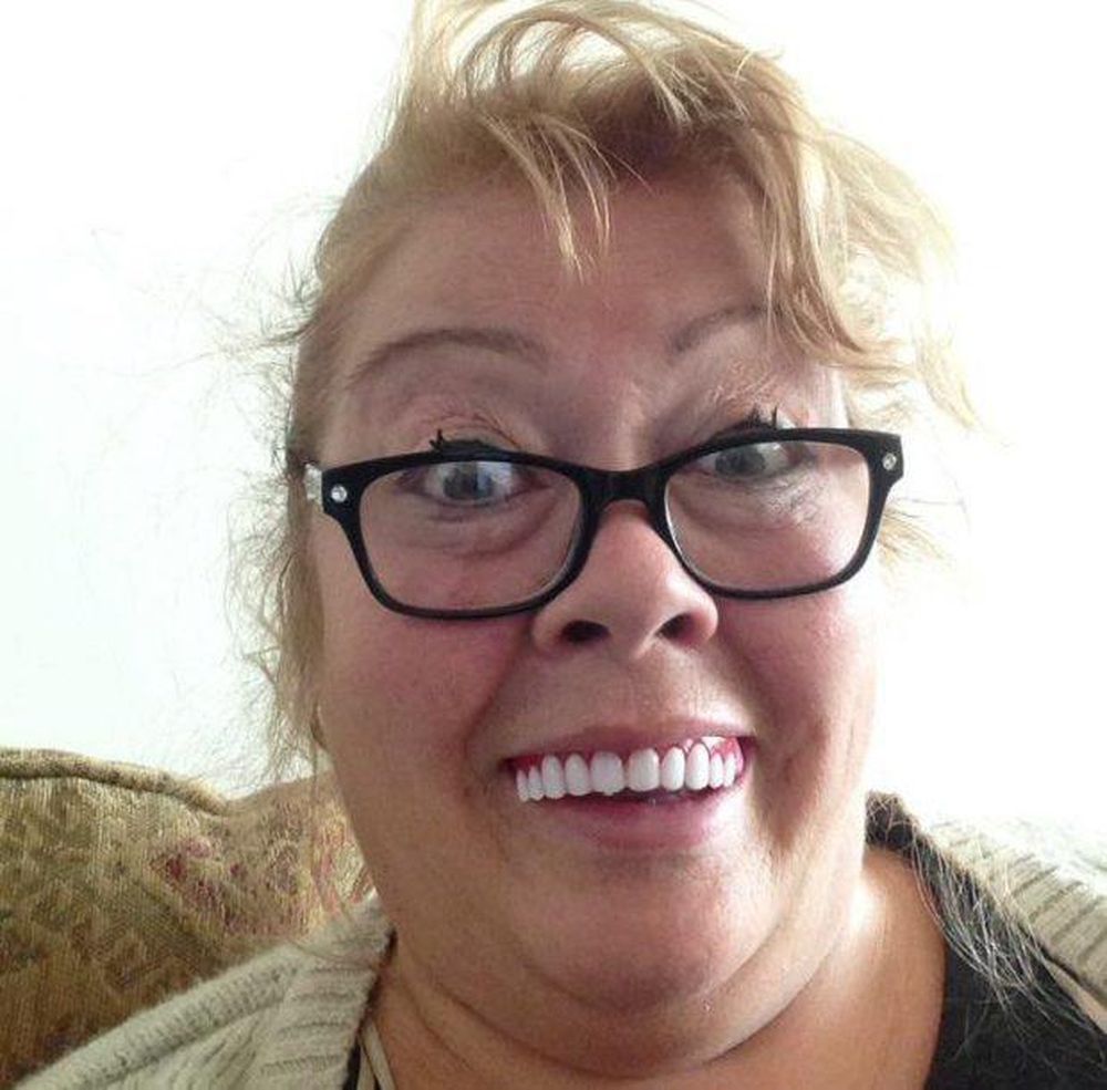 clip on veneers - sue robertson